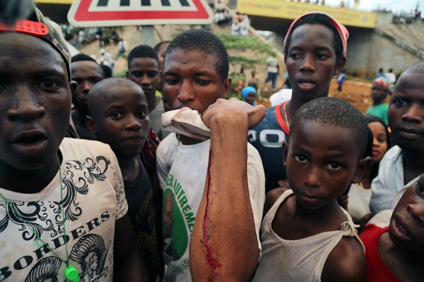 A man shows an injury he sustained at a rally in support of then-UFDG presidential candidate Cellou Dalein Diallo, Conakry, Guinea, Oct. 8, 2015 (AP photo by Youssouf Bah).